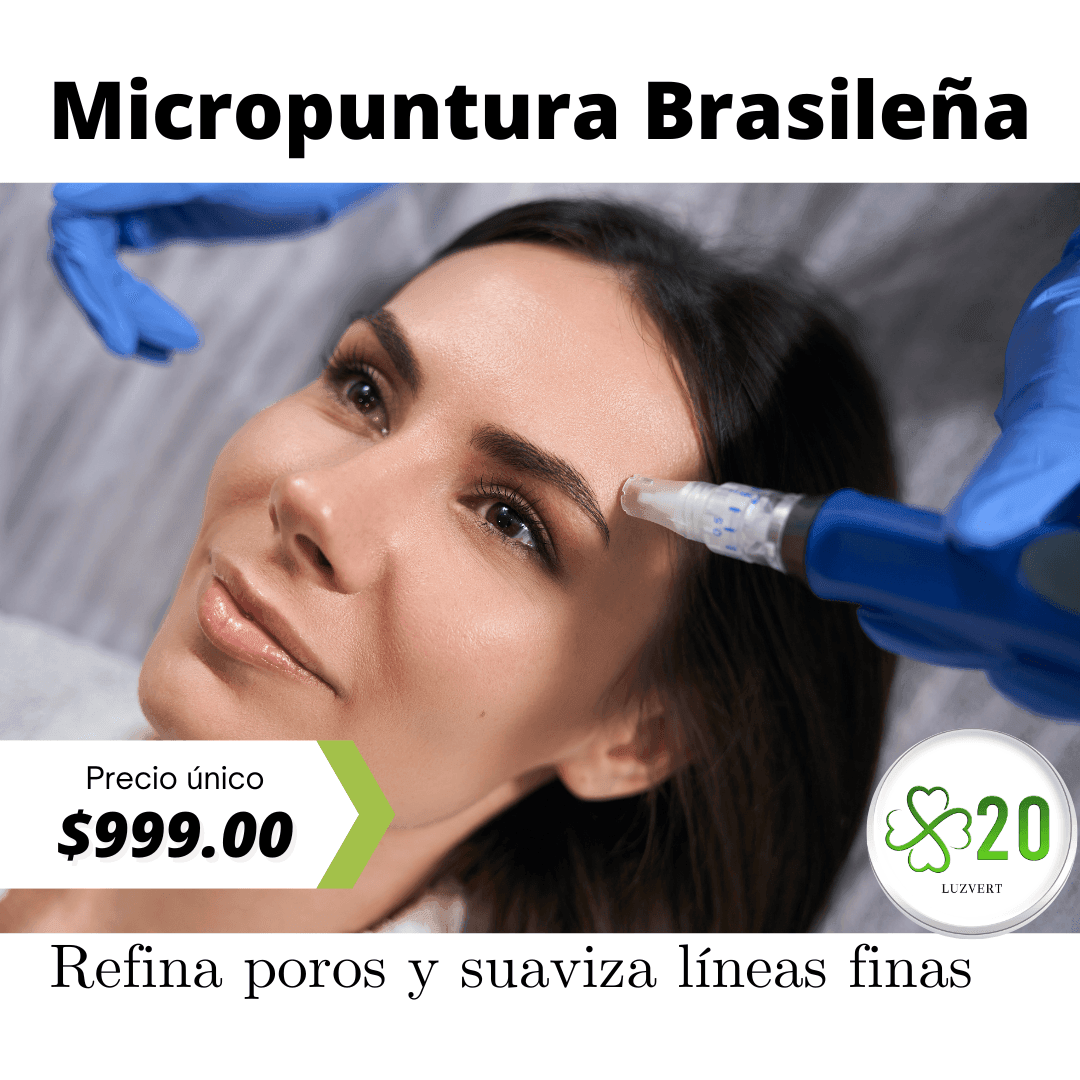 Lifting Facial sin cirugía con Micropuntura Brasileña