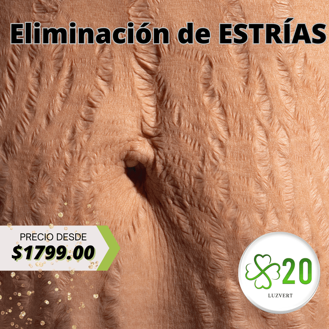 Regeneración de estrías en CDMX